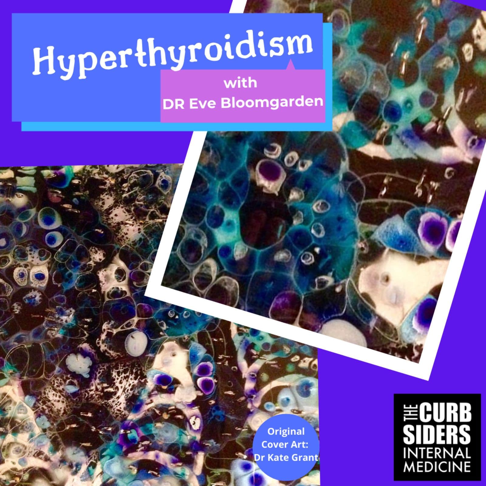 #228 Thyroid on Fire! Hyperthyroidism with Dr. Eve Bloomgarden