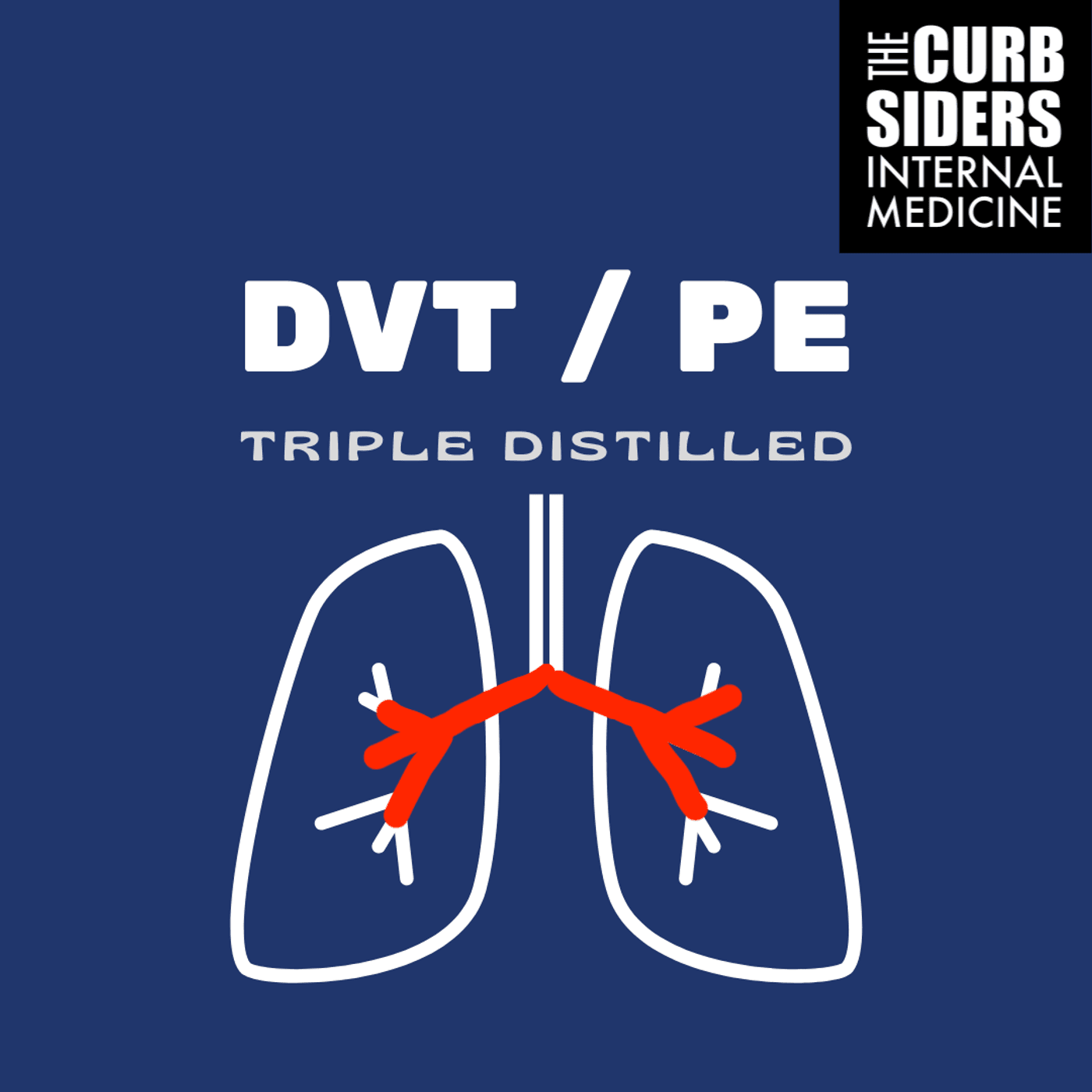#238 DVT / PE Triple Distilled