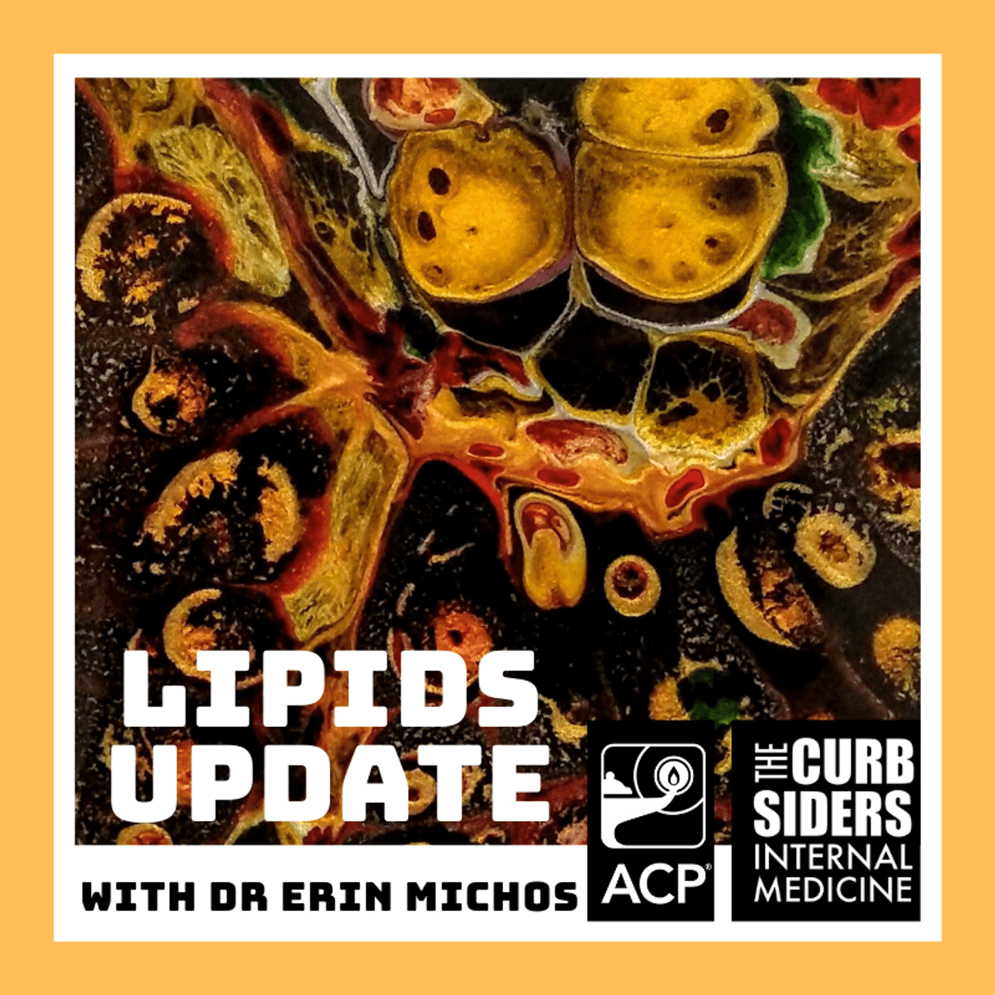 #191 Lipids Update with Erin Michos MD