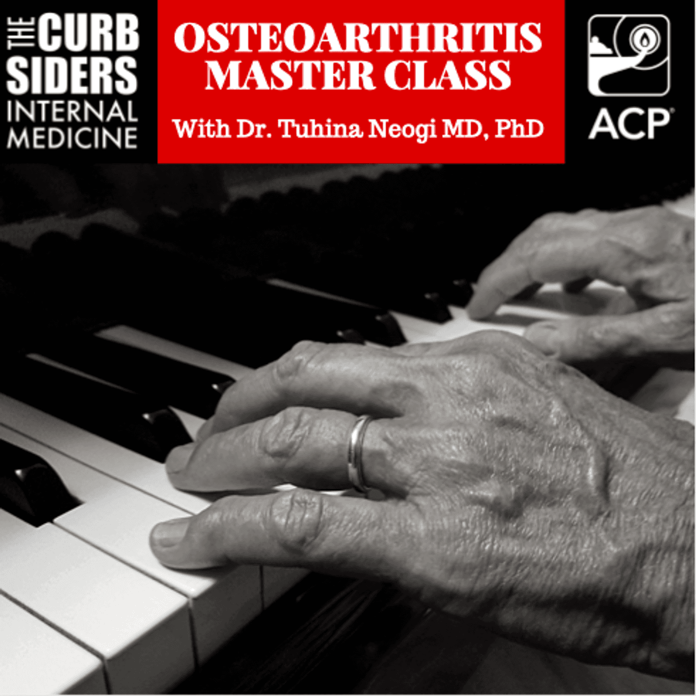 #177 Osteoarthritis Master Class with Tuhina Neogi MD, PhD