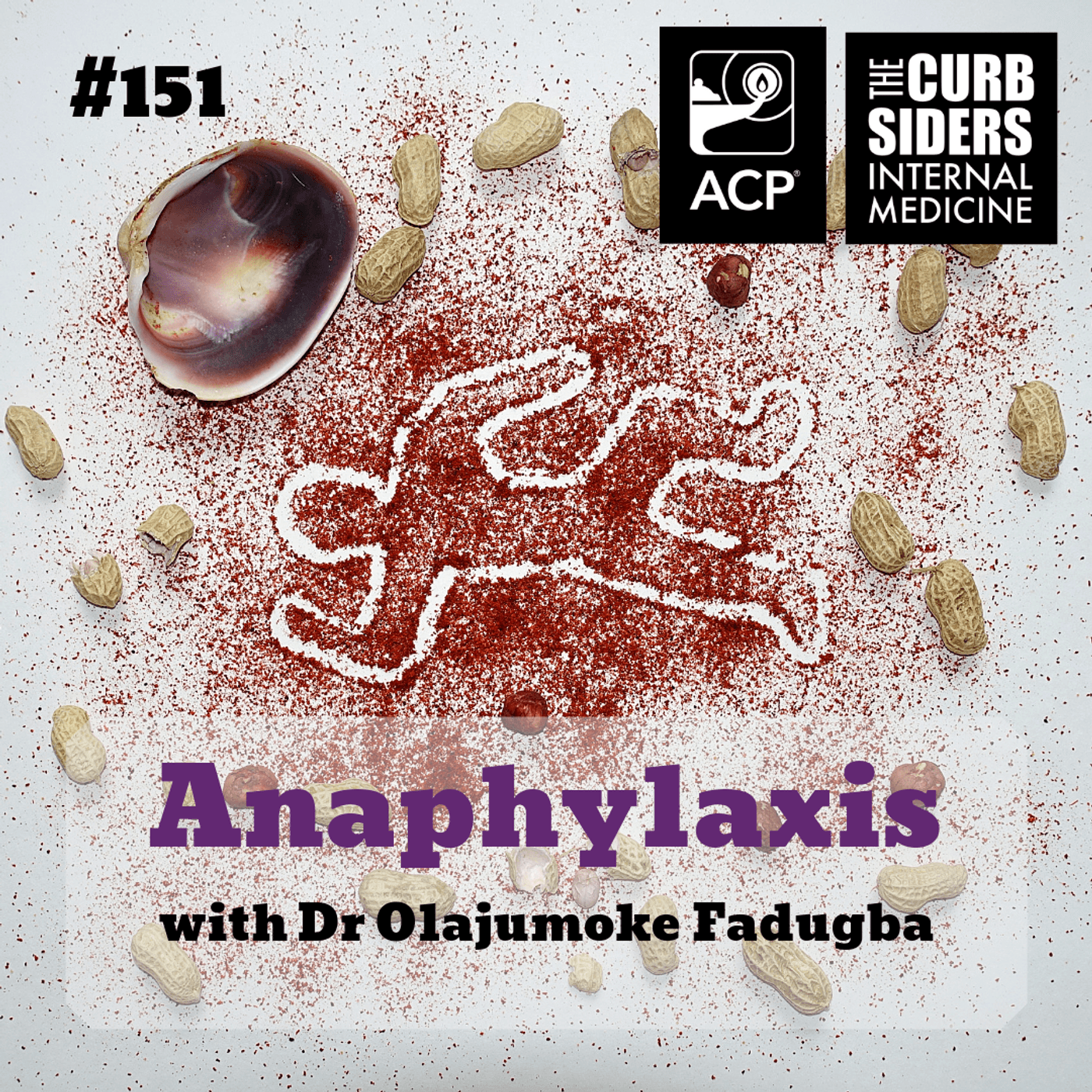 #151 Anaphylaxis with Dr Olajumoke Fadugba MD