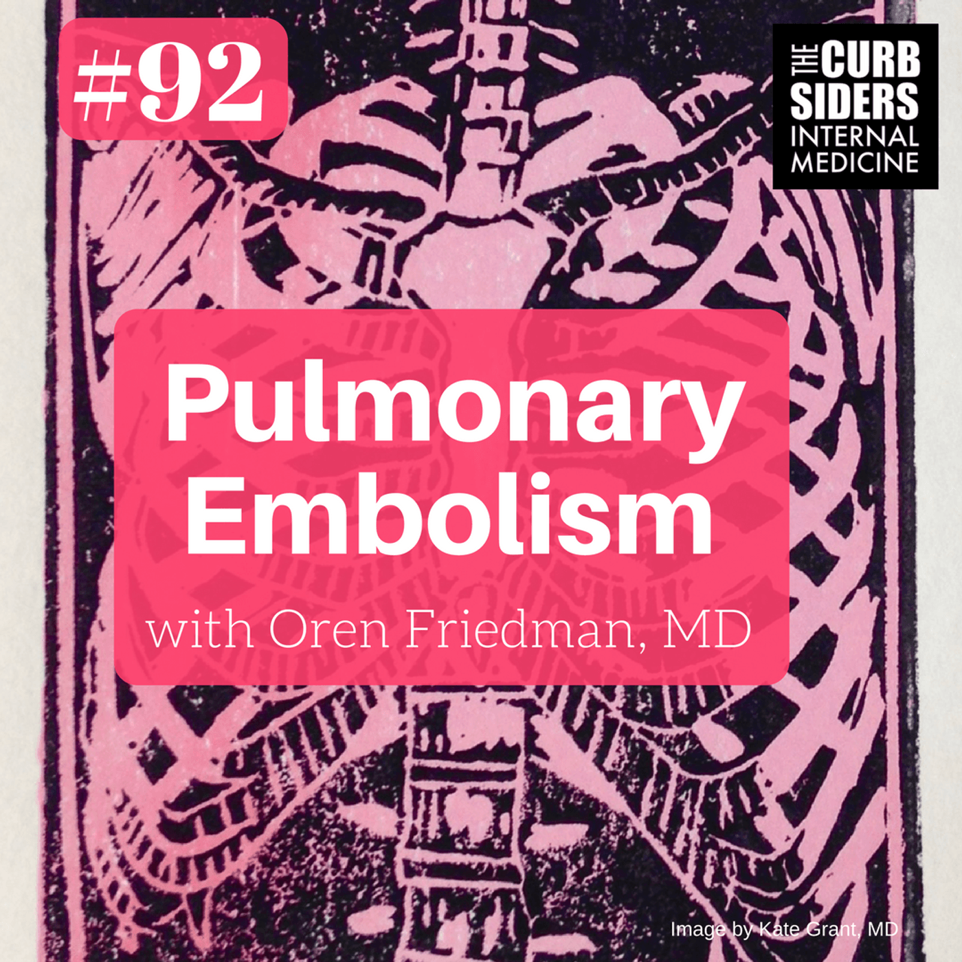 #92: Pulmonary Embolism for the Internist