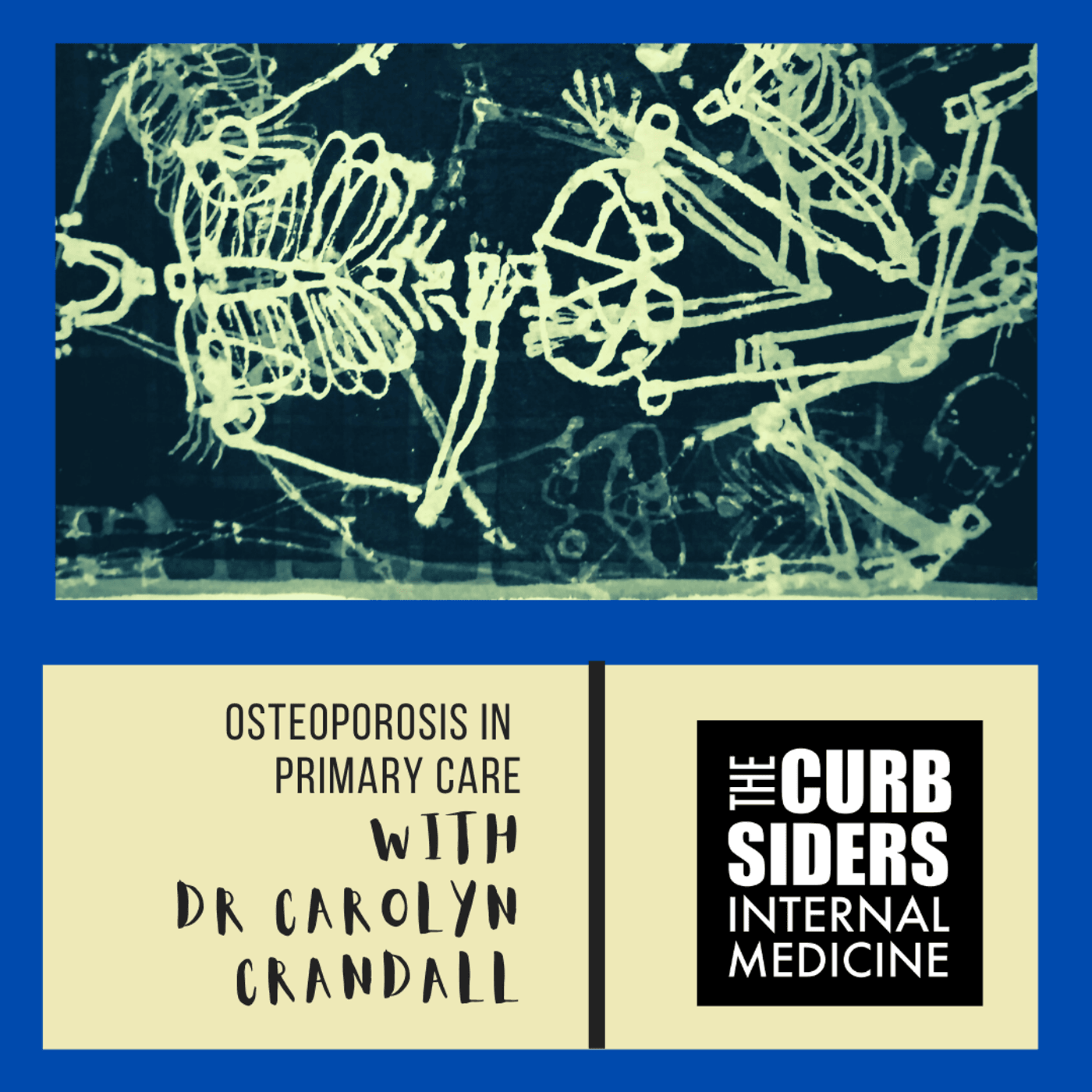 #277 Bone Up on Osteoporosis in Primary Care with Dr. Carolyn Crandall