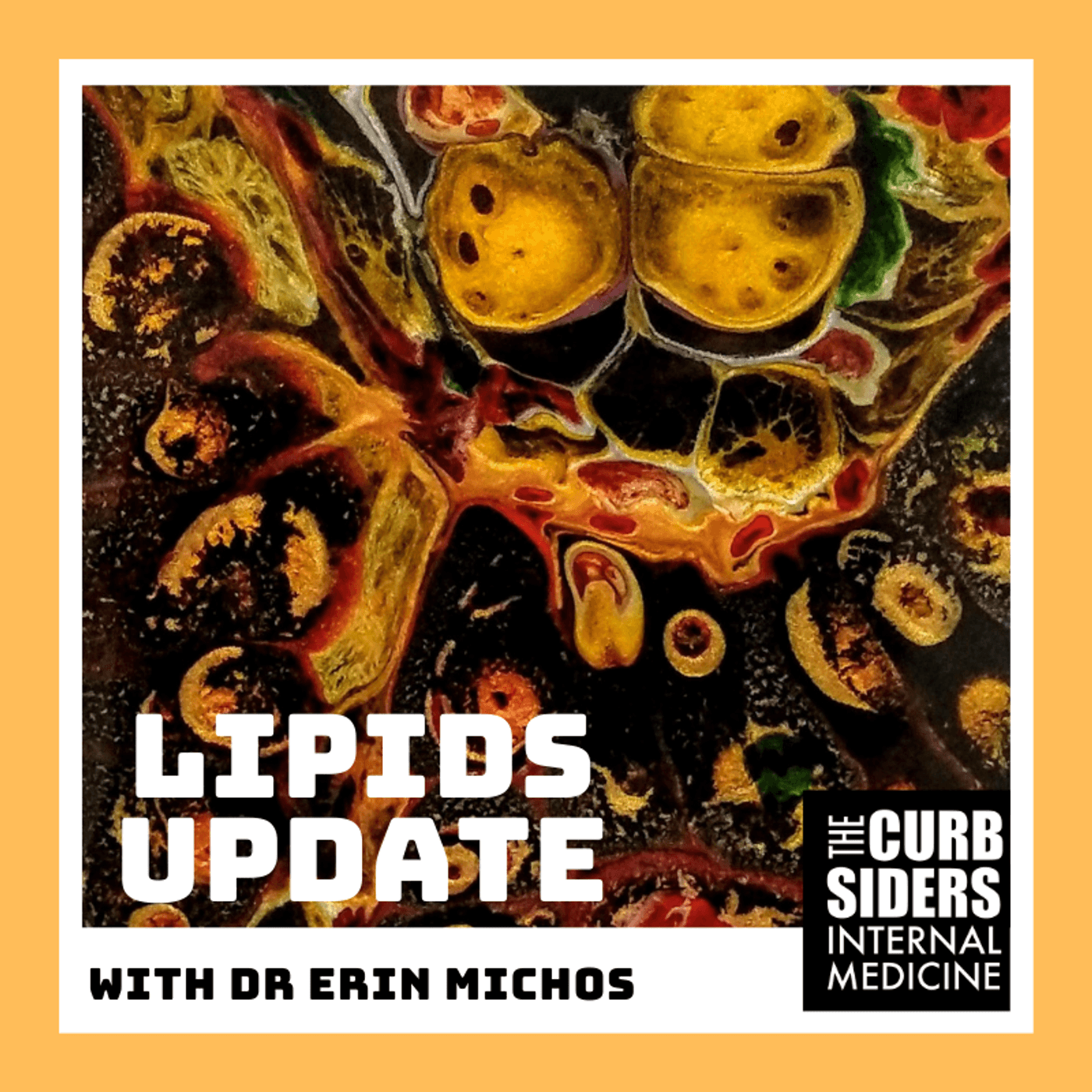 REBOOT #191 Lipids and Cardiovascular Risk Reduction with Erin Michos MD