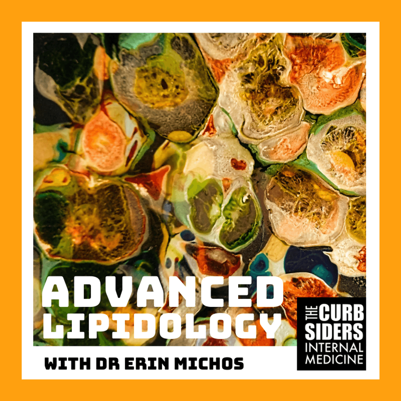 #361 Advanced Lipidology