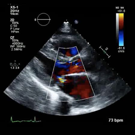 Association Between Offering Limited LVEF Echocardiograms and Overall Use of Echocardiography