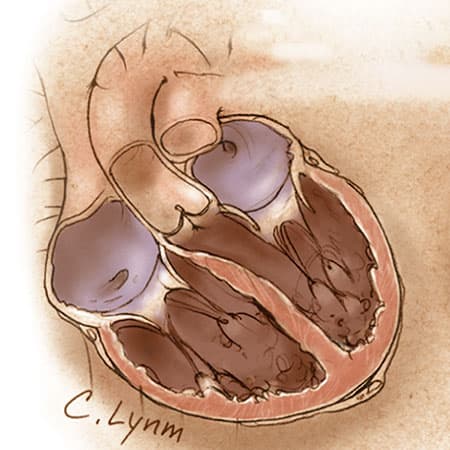 Management of Heart Failure in 2019-2020, Part 1