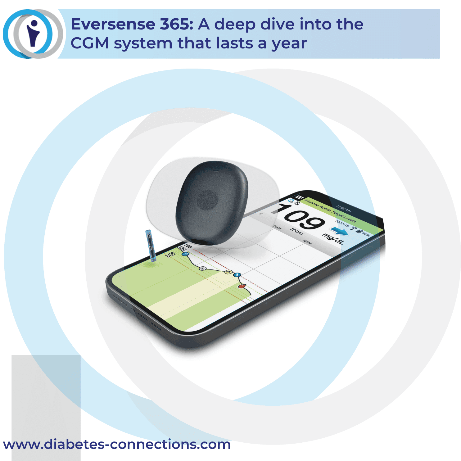 Eversense 365: A deep dive into the  CGM system that lasts a year