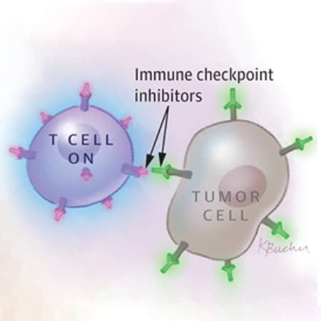Management of Immunotherapy-Related Toxicities