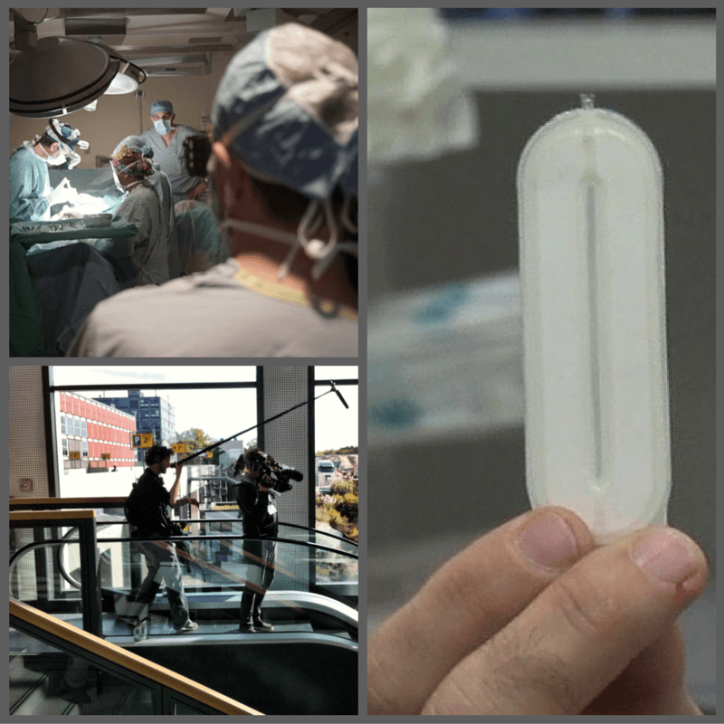 Stem Cells as a Potential Cure for Type 1 Diabetes: ViaCyte & "The Human Trial"