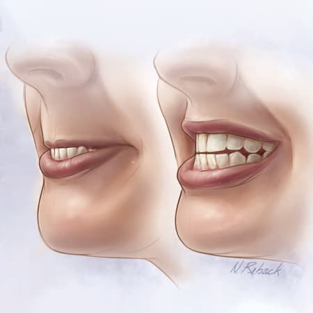 Will This Patient Be Difficult to Intubate? A Rational Clinical Examination Review