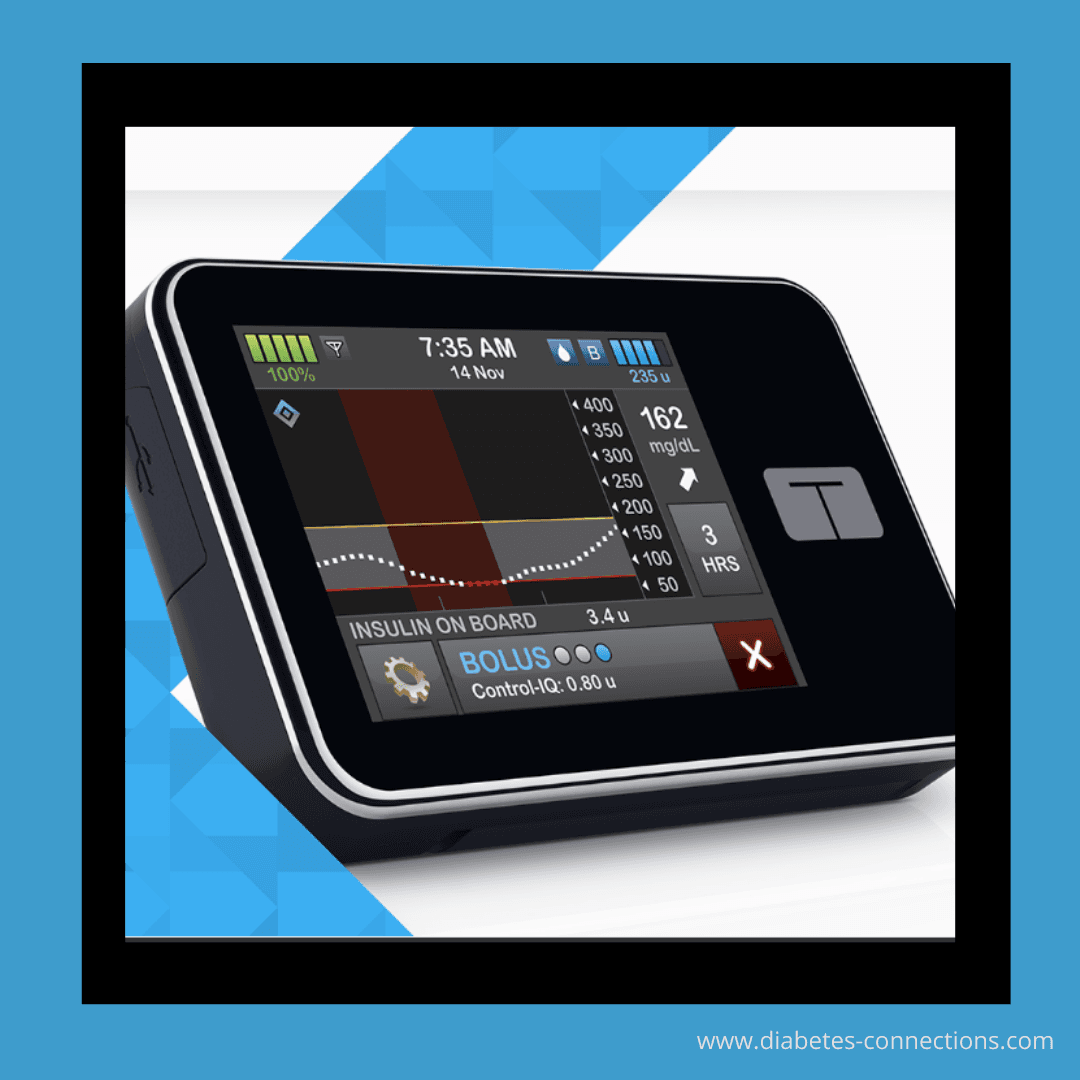 "A First Look Under The Hood" - Control IQ Studies & What's Next From Tandem