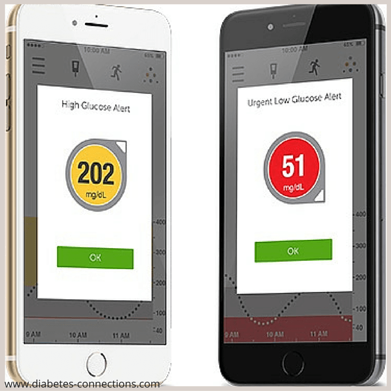 Dexcom CGM Use: Real Life vs Labeling