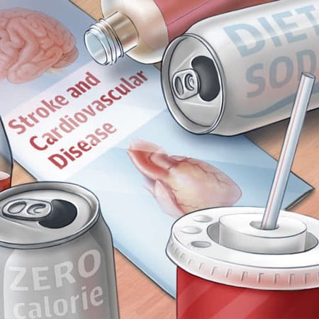 Unpacking A Recent Study Linking Diet Soda With Stroke Risks