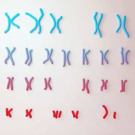 Diagnosing Congenital and Intellectual Abnormalities With Chromosomal Microarray Analysis