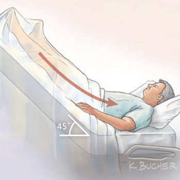 Fluid Resuscitation for Patients in Septic Shock
