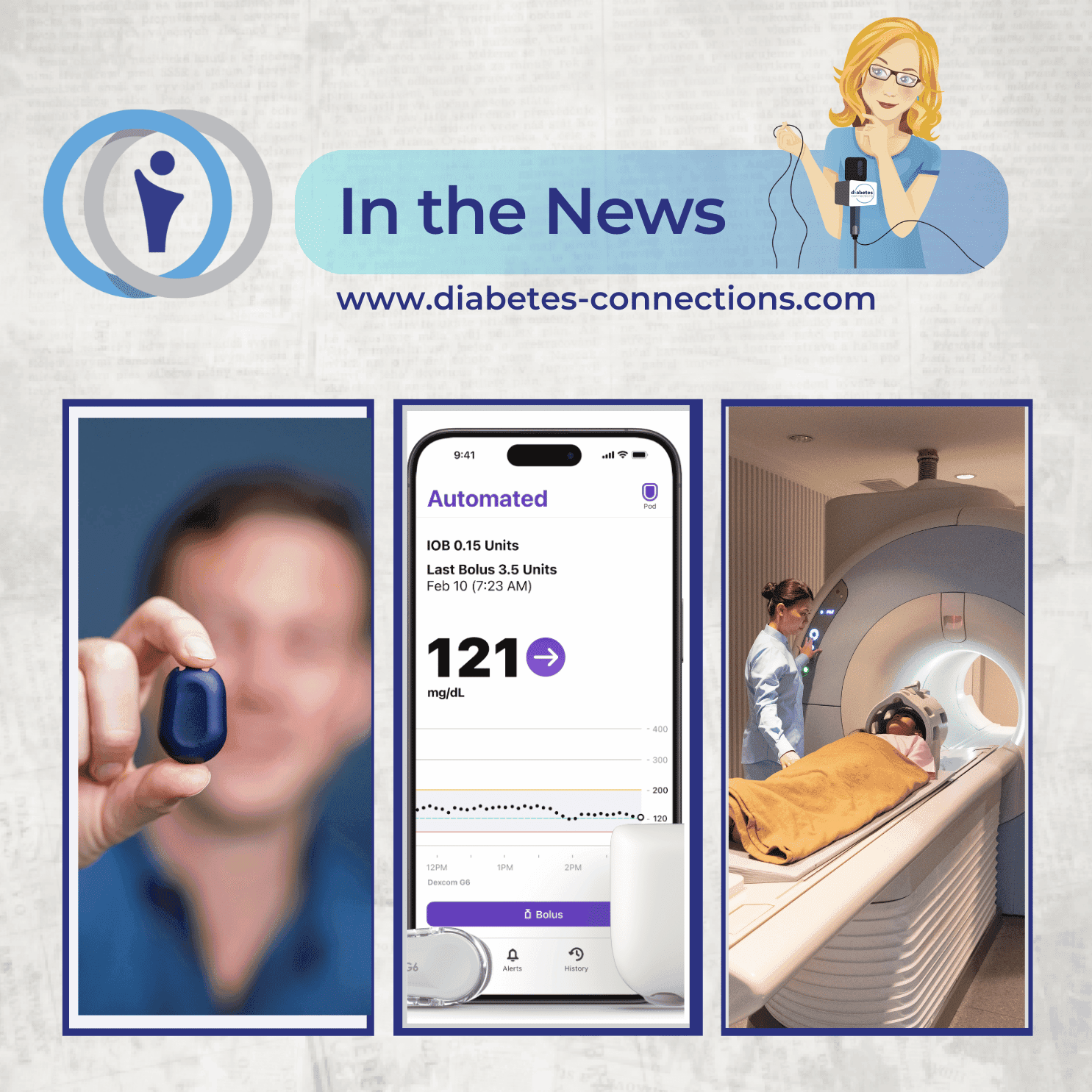 In the News... Omnipod 5 iPhone update, Libre & Dexcom news, overnight insulin pump and more!