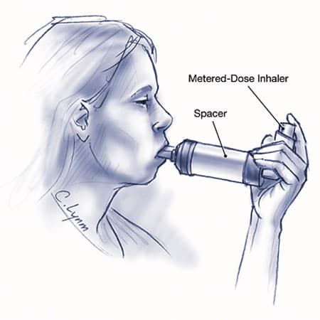 How to Diagnose and Manage Adult Asthma