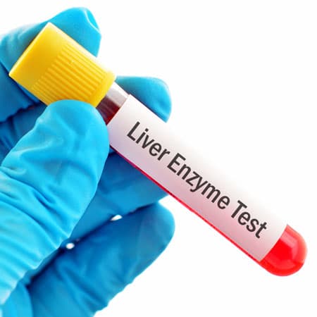 Elevated Liver Function Tests Following Liver Transplant