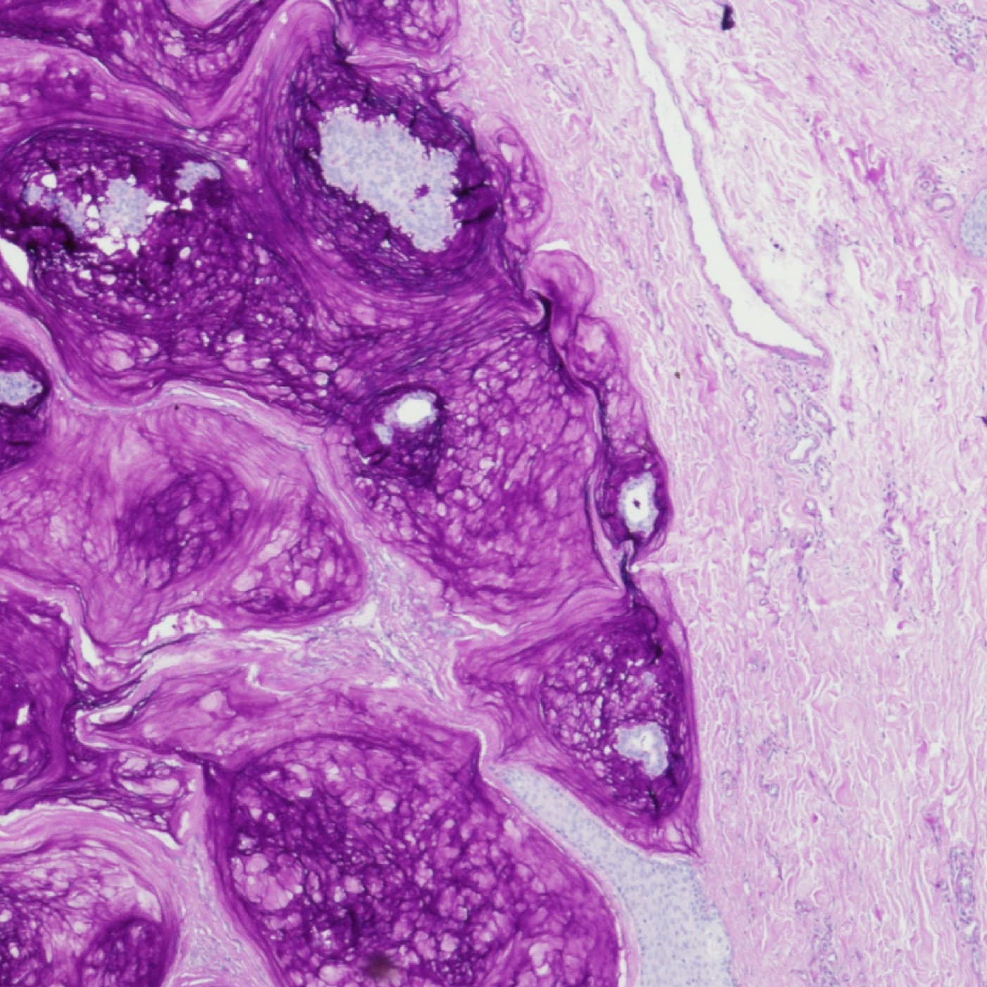 Advancing Skin Cell Biology with Kathleen Green, PhD
