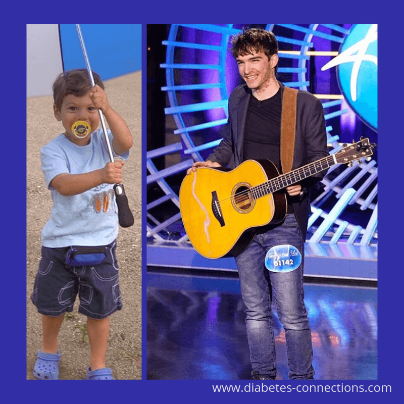 American Idol's Jackson Gillies Lives with T1D & HS / Benny & Stacey at the Endo
