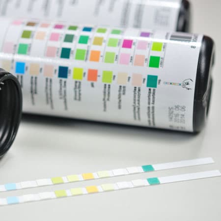 Cost-Effectiveness of Diagnostic Approaches for Asymptomatic Microscopic Hematuria
