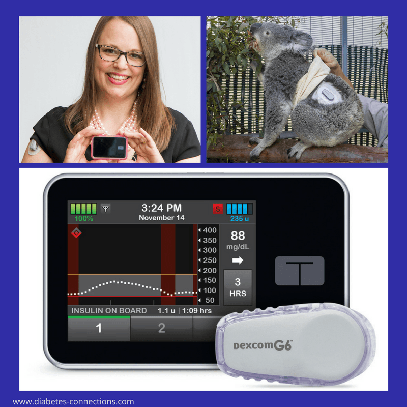 Preventing Lows Automatically - Tandem's Basal IQ