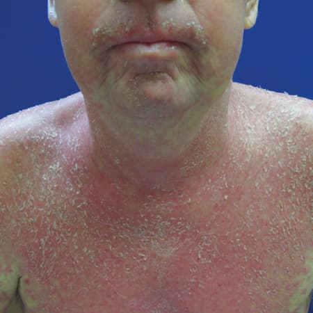 Ten Things Every New Doctor Should Know About Drug Reactions