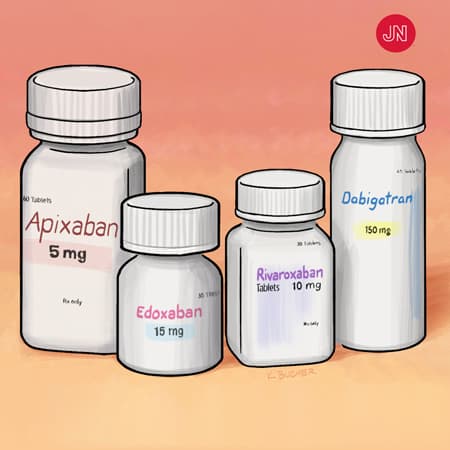 Review of Atrial Fibrillation Treatment
