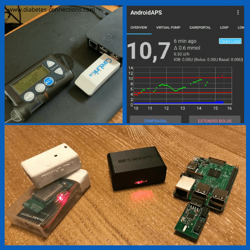 Loop, OpenAPS and Other DIY Systems for T1D