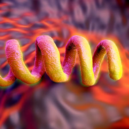 What you need to know about syphilis in 2018