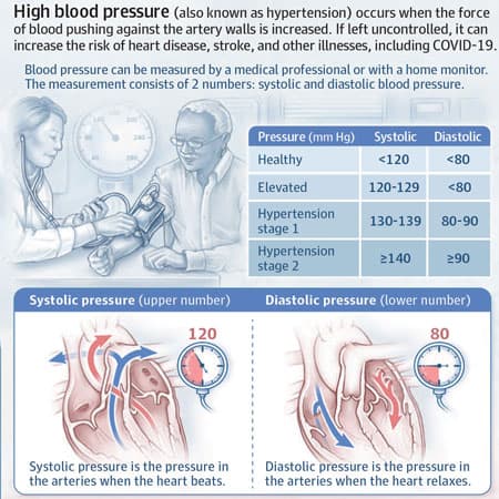 USPSTF Recommendation: Screening for Hypertension in Adults