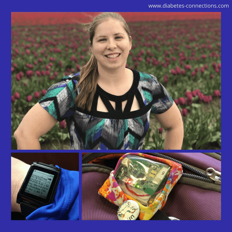 What's Next for #OpenAPS and Dana Lewis?