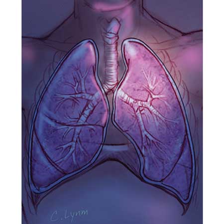 The Nature of Lung Microbiome Research