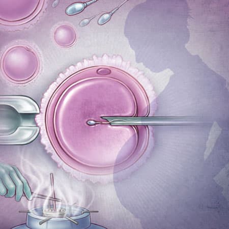 Diagnosis and Treatment of Infertility