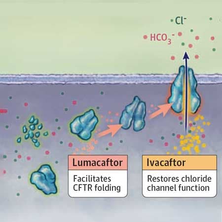 Matching Drugs to Genetic Abnormalities to Precisely Treat Cystic Fibrosis
