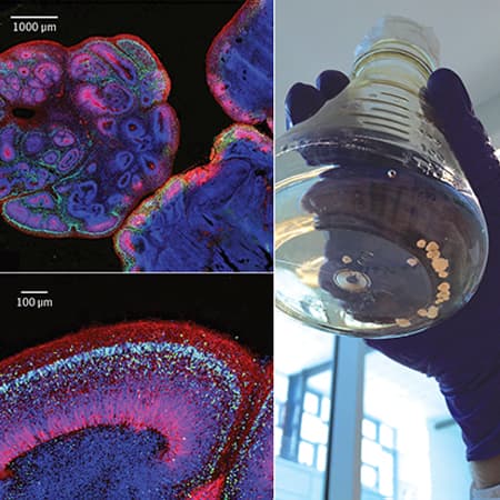 For Difficult-to-Model Brain Diseases, Brain Organoids Come to the Rescue