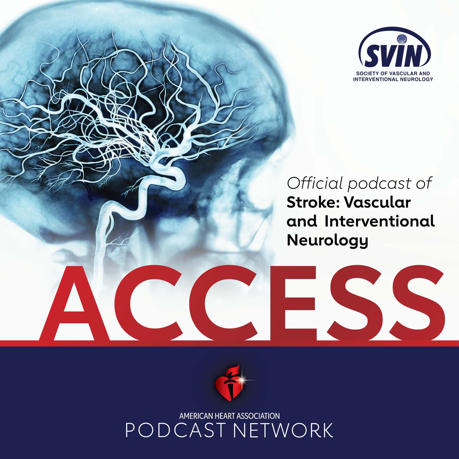 ACCESS S:VIN March 2025