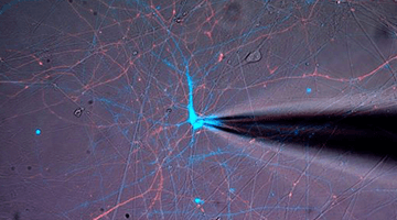 Investigating Therapies for Genetic Epilepsy with Alfred George, Jr., MD