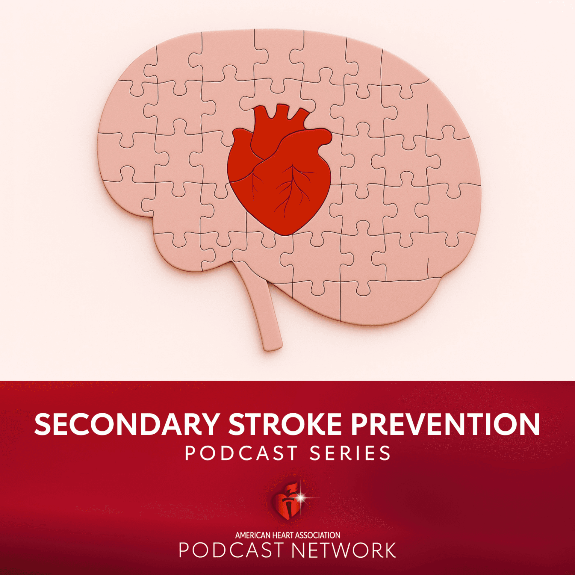 Secondary Stroke Prevention: Where Are We Now?