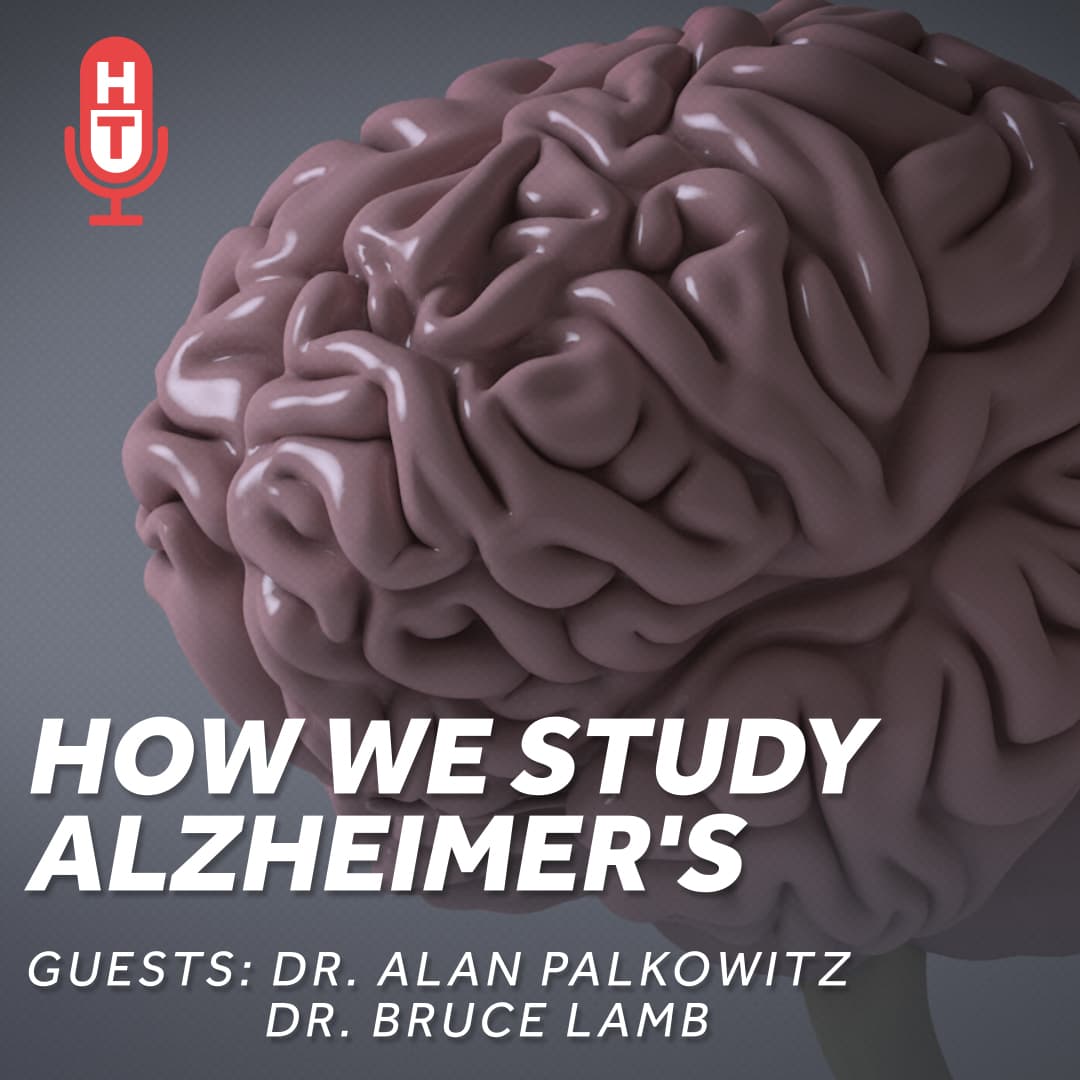 How We Study Alzheimer's and Potential Treatments